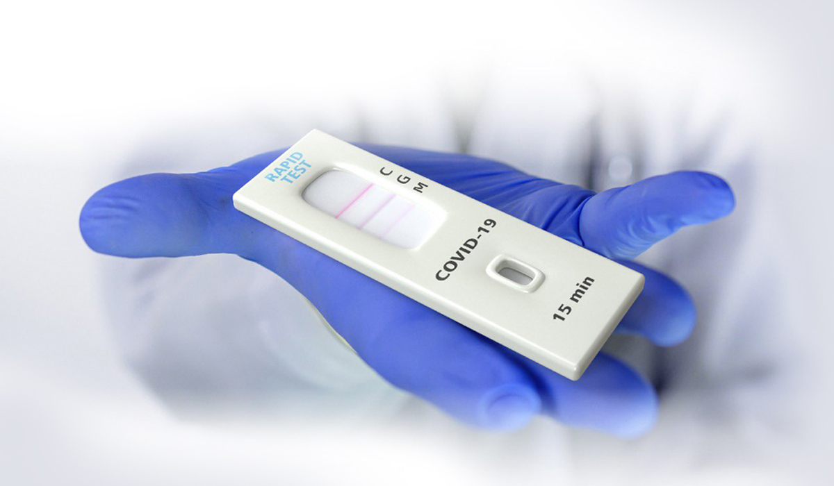 Rapid Antigen Test